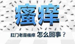肛門瘙癢治不好嗎？先檢查病因就好辦！